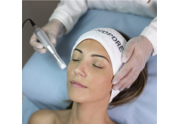 Hier sind 10 Gründe, die für eine Microneedling-Behandlung sprechen